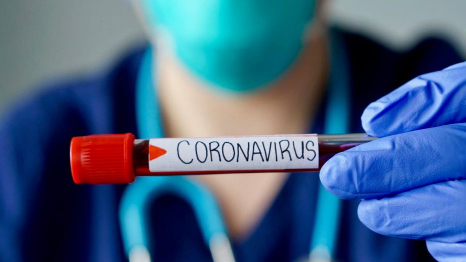 pruebas de coronavirus en Cuba